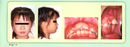 名流牙醫診所,名流牙科矯正中心,齒顎矯正,全口重建,牙醫美容,植牙,美白,貼片